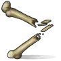 Обломки костей